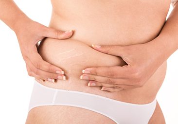 Medical weight loss