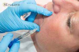 Dermal Fillers