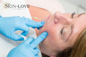 Dermal Fillers