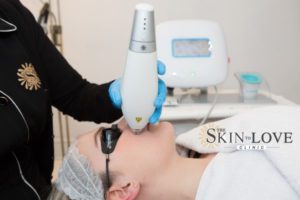 Clear and brilliant treatment