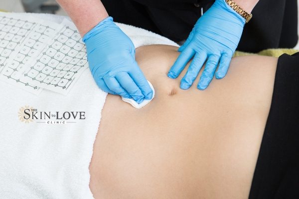 Thermage Works Skin Tightening: Thermage FLX Skin Treatment for an Overall Younger Looking Appearance.