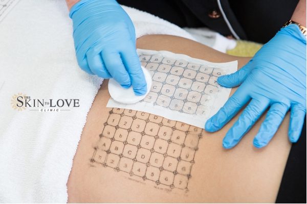 Thermage FLX Skin Radiofrequency Technology. Reduce Fine Lines in a Single Treatment and get Smoother Skin with Thermage FLX.