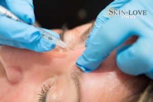 Wrinkle Relaxing Injections