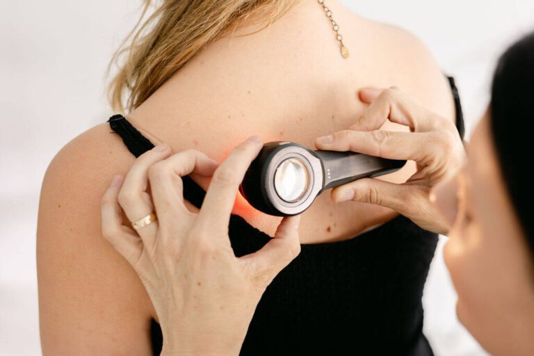 Dermatologist discussing mole removal procedure and pricing with a patient in a clinic setting