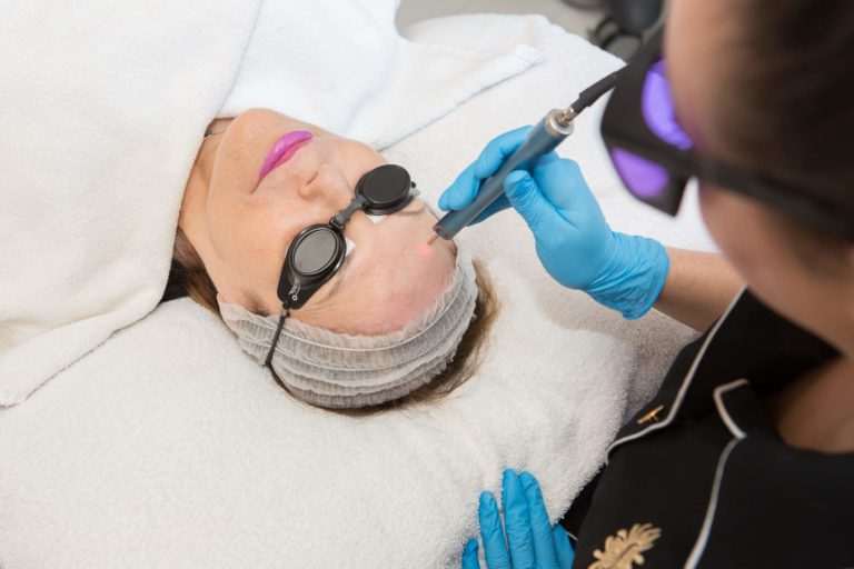Regenlite Treatment For Acne Scarring