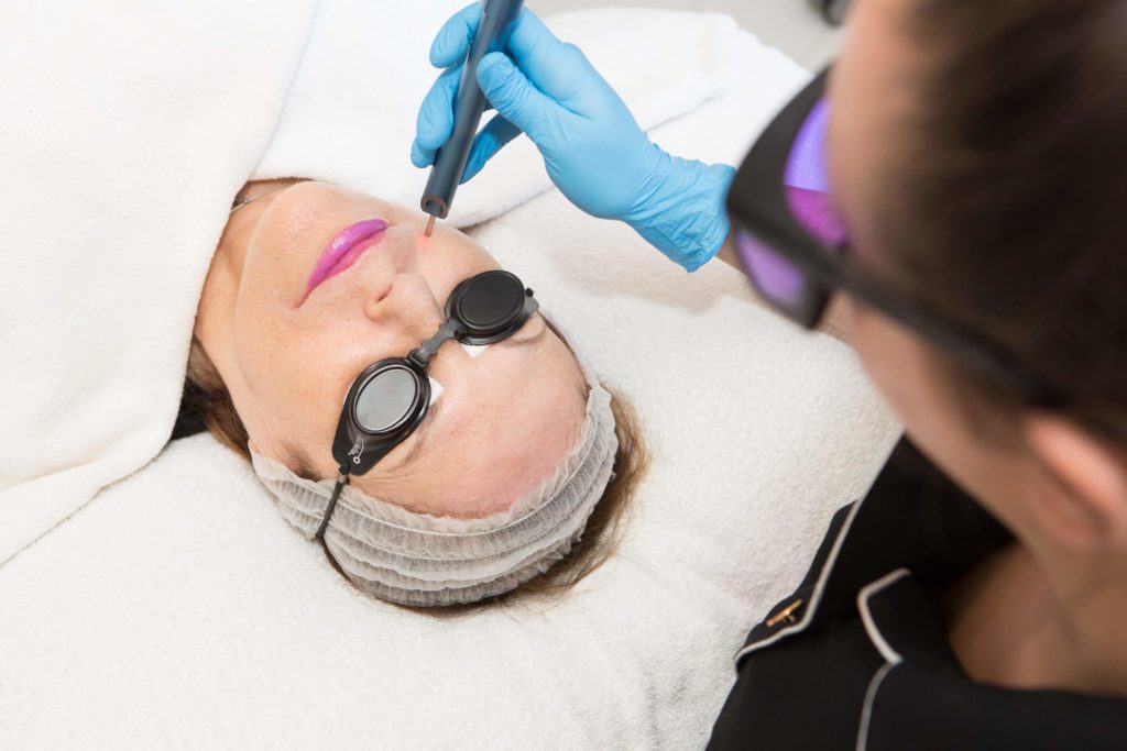Regenlite Treatment For Acne Scarring