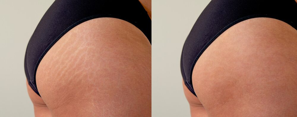 desobody before and after
