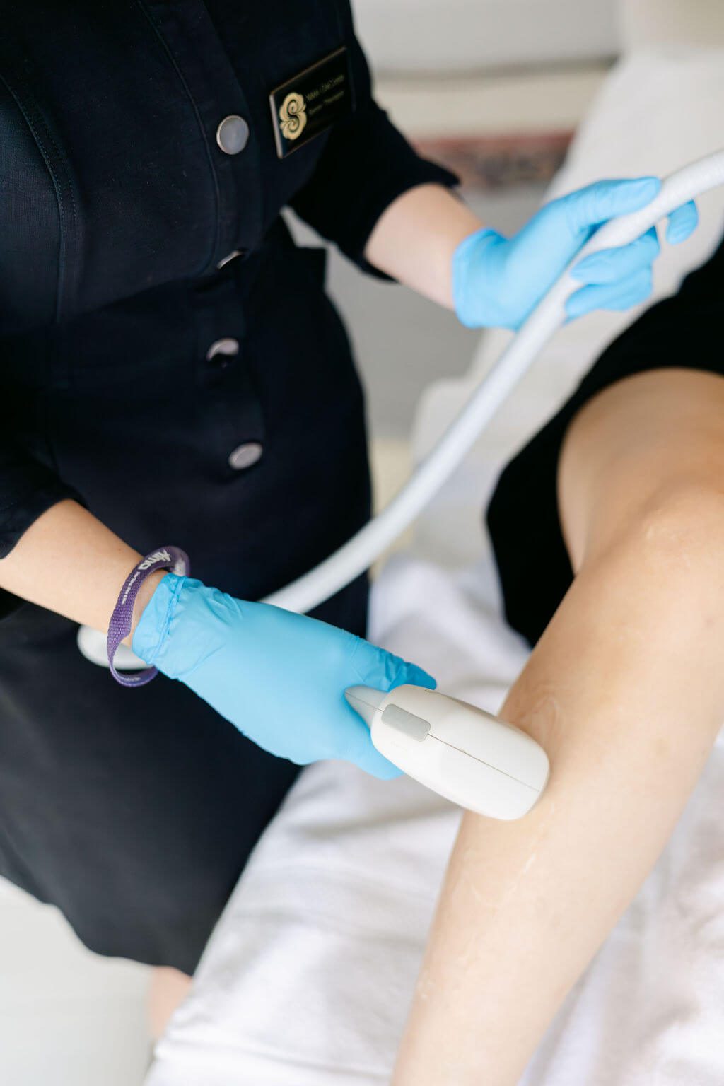 laser hair removal
